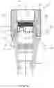 Fig. 04 - Dental component with an interface