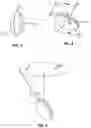 Fig. 03 - ENDODONTIC INSTRUMENTS DISPLAYING COMPRESSIBILITY
