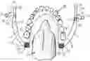 Fig. 01 - INTRA-ORAL APPLIANCE FOR FIELD ISOLATION AND MOISTURE CONTROL