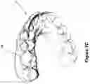 Fig. 13 - System and method for digital tooth imaging