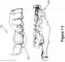 Fig. 16 - System and method for digital tooth imaging