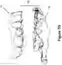 Fig. 17 - System and method for digital tooth imaging