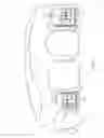 Fig. 03 - Integrated braces with veneers, crowns, or bridges