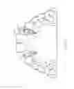 Fig. 15 - Integrated braces with veneers, crowns, or bridges
