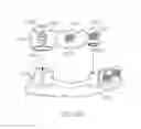 Fig. 16 - Integrated braces with veneers, crowns, or bridges