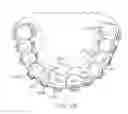 Fig. 17 - Integrated braces with veneers, crowns, or bridges
