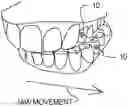 Fig. 01 - Virtual dental articulator and system