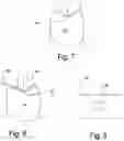 Fig. 05 - Virtual dental articulator and system
