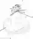 Fig. 01 - Mounting element for production of a dental prosthesis, a prosthesis and method of manufacturing same