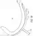 Fig. 03 - Saliva management system