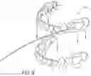 Fig. 10 - Saliva management system