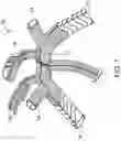 Fig. 02 - Endoluminal device