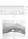 Fig. 02 - IMPLANTABLE DEVICE