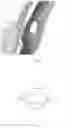 Fig. 03 - IMPLANTABLE DEVICE
