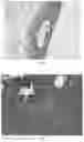 Fig. 05 - IMPLANTABLE DEVICE