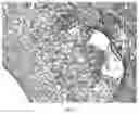 Fig. 06 - IMPLANTABLE DEVICE