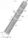 Fig. 01 - VASCULAR GRAFT PROTECTOR