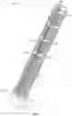 Fig. 05 - VASCULAR GRAFT PROTECTOR