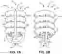 Fig. 03 - Bone Anchor and Related Devices, Systems, and Methods