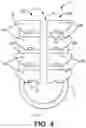 Fig. 05 - Bone Anchor and Related Devices, Systems, and Methods