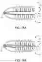 Fig. 11 - Bone Anchor and Related Devices, Systems, and Methods