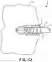 Fig. 12 - Bone Anchor and Related Devices, Systems, and Methods
