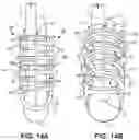 Fig. 14 - Bone Anchor and Related Devices, Systems, and Methods