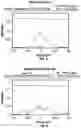 Fig. 07 - Ophthalmic devices, system and methods that improve peripheral vision