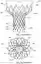 Fig. 02 - Valve prostheses having an integral centering mechanism and methods of use thereof