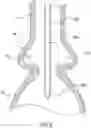 Fig. 06 - Valve prostheses having an integral centering mechanism and methods of use thereof