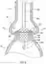 Fig. 08 - Valve prostheses having an integral centering mechanism and methods of use thereof