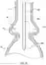 Fig. 12 - Valve prostheses having an integral centering mechanism and methods of use thereof