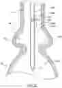 Fig. 20 - Valve prostheses having an integral centering mechanism and methods of use thereof