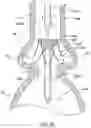 Fig. 21 - Valve prostheses having an integral centering mechanism and methods of use thereof
