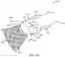 Fig. 10 - Prosthetic mitral valve and delivery method