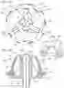 Fig. 02 - Pre-constricted prosthetic heart valves