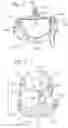 Fig. 06 - Pre-constricted prosthetic heart valves