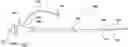 Fig. 01 - Expandable introducer sheath