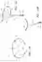 Fig. 27 - Device, system, and method for transcatheter treatment of valve regurgitation