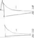 Fig. 29 - Device, system, and method for transcatheter treatment of valve regurgitation