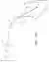 Fig. 31 - Device, system, and method for transcatheter treatment of valve regurgitation