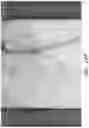 Fig. 34 - Device, system, and method for transcatheter treatment of valve regurgitation