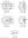 Fig. 03 - Location, time, and/or pressure determining devices, systems, and methods for deployment of lesion-excluding heart implants for treatment of cardiac heart failure and other disease states