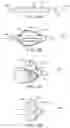Fig. 07 - Location, time, and/or pressure determining devices, systems, and methods for deployment of lesion-excluding heart implants for treatment of cardiac heart failure and other disease states