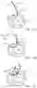 Fig. 10 - Location, time, and/or pressure determining devices, systems, and methods for deployment of lesion-excluding heart implants for treatment of cardiac heart failure and other disease states