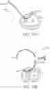 Fig. 11 - Location, time, and/or pressure determining devices, systems, and methods for deployment of lesion-excluding heart implants for treatment of cardiac heart failure and other disease states