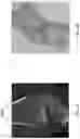 Fig. 03 - Kinematic and parameterized modeling for patient-adapted implants, tools, and surgical procedures