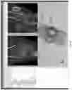 Fig. 07 - Kinematic and parameterized modeling for patient-adapted implants, tools, and surgical procedures