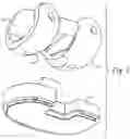 Fig. 03 - Method Of Designing Orthopedic Impants Using In Vivo