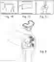 Fig. 07 - Method Of Designing Orthopedic Impants Using In Vivo